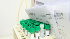 Laboratory tests
